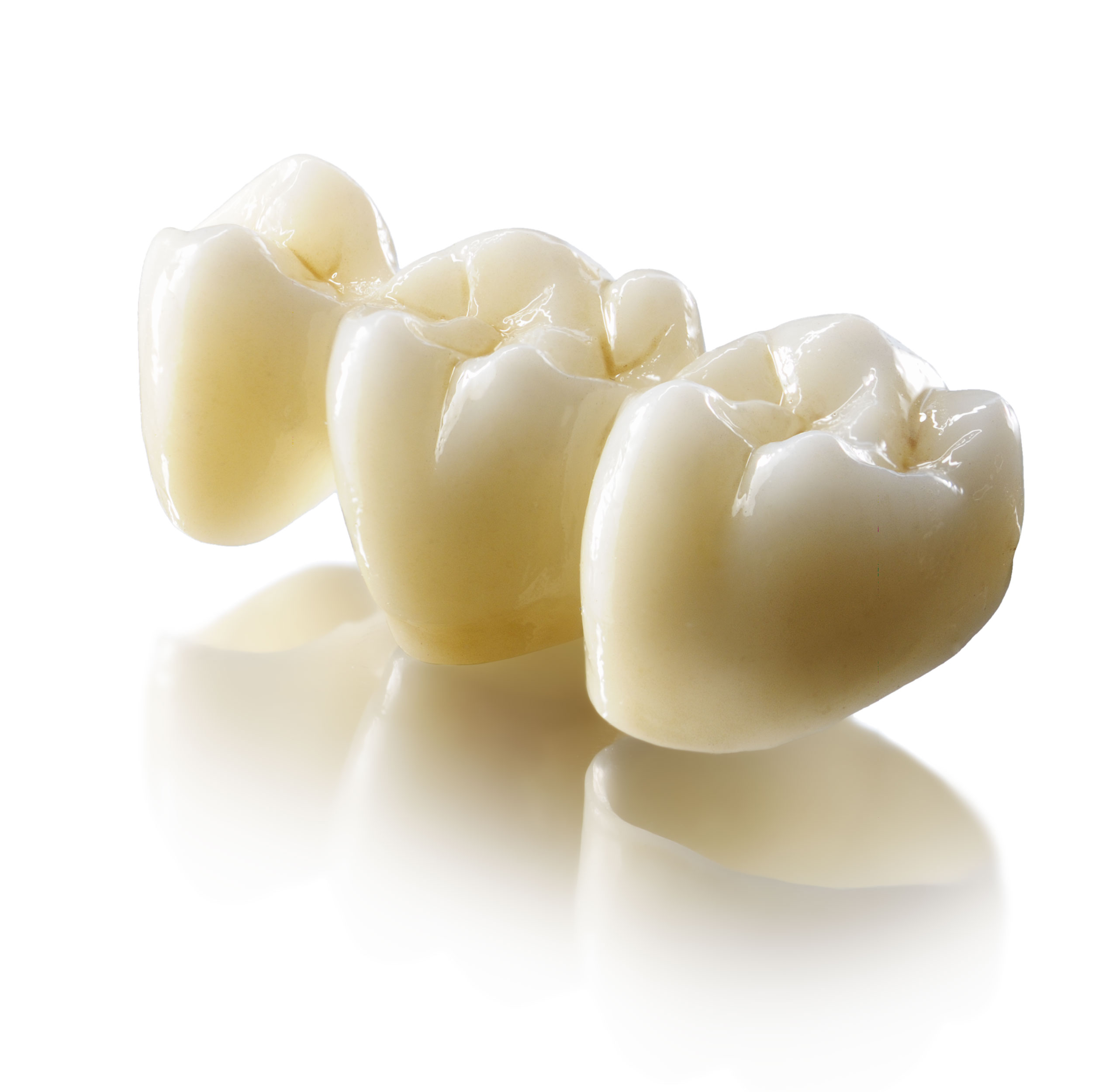 Зубные протезы из диоксида циркония — будущее стоматологии