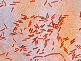 У 10 трудовых мигрантов в Перми обнаружили брюшной тиф